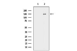 anti-Chromatin Assembly Factor 1, Subunit A (p150) (CHAF1A) (Internal Region) antibody