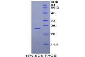 SDS-PAGE (SDS) image for Metalloproteinase Inhibitor 2 (TIMP2) (AA 27-220) protein (His tag) (ABIN1080959) (TIMP2 Protein (AA 27-220) (His tag))