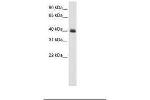 Image no. 1 for anti-Pseudouridylate Synthase 1 (PUS1) (C-Term) antibody (ABIN6736124) (PUS1 anticorps  (C-Term))