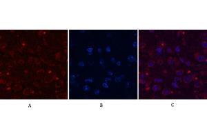 Immunofluorescence analysis of mouse brain tissue. (Aquaporin 4 anticorps)