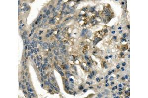IHC analysis of LDLR using anti-LDLR antibody (ABIN7601438).