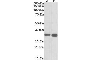 AP31565PU-N PDXP antibody staining of Mouse (A) and Rat (B) Brain lysates at 0.