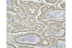 IHC analysis of HSPD1 using anti-HSPD1 antibody (ABIN7600976). (HSPD1 anticorps  (AA 260-496))