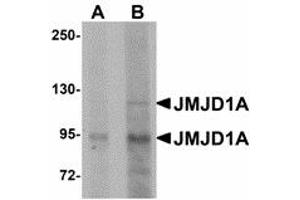 Image no. 1 for anti-Lysine (K)-Specific Demethylase 3A (KDM3A) (N-Term) antibody (ABIN478151) (KDM3A anticorps  (N-Term))
