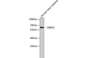 Western blot analysis of extracts of human fetal intestine, using GRB14 antibody (ABIN3016578, ABIN3016579, ABIN1680099 and ABIN1680100).