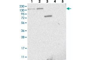 Western blot analysis of Lane 1: RT-4, Lane 2: U-251 MG, Lane 3: Human Plasma, Lane 4: Liver, Lane 5: Tonsil with PPP2R3A polyclonal antibody  at 1:250-1:500 dilution. (PPP2R3A anticorps)