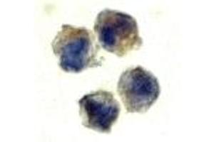 Immunohistochemistry (IHC) image for anti-Interleukin 22 Receptor (IL22R) (N-Term) antibody (ABIN1031411) (IL22R anticorps  (N-Term))