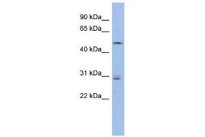SMAP1 antibody used at 1 ug/ml to detect target protein. (SMAP1 anticorps  (Middle Region))