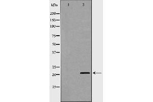 Western blot analysis of Hela whole cell lysates, using p21 Cip1 Antibody. (p21 anticorps  (Internal Region))