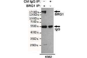 Immunoprecipitation analysis of K562 cell lysates using BRG1 mouse mAb (201025). (SMARCA4 anticorps)