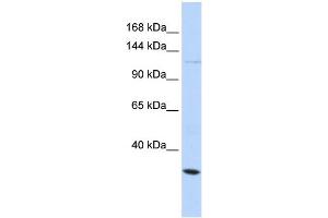 WB Suggested Anti-KCNMA1 Antibody Titration:  0. (KCNMA1 anticorps  (Middle Region))