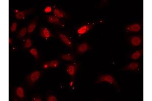 Immunofluorescence analysis of U2OS cells using HNRNPF antibody.