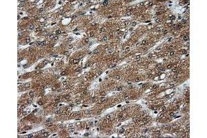 Image no. 6 for anti-Proteasome (Prosome, Macropain) 26S Subunit, ATPase, 3 (PSMC3) antibody (ABIN1501335)