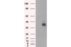 HEK293T cells were transfected with the pCMV6-ENTRY control (Left lane) or pCMV6-ENTRY BSG (Right lane) cDNA for 48 hrs and lysed. (CD147 anticorps)