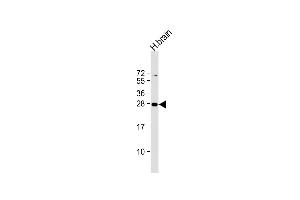 Anti-PLD6 Antibody (Center) at 1:2000 dilution + human brain lysate Lysates/proteins at 20 μg per lane.