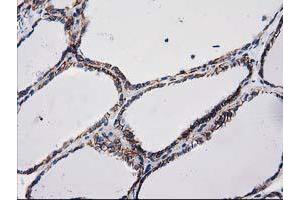 Image no. 1 for anti-Catenin (Cadherin-Associated Protein), beta 1, 88kDa (CTNNB1) antibody (ABIN1496890) (CTNNB1 anticorps)