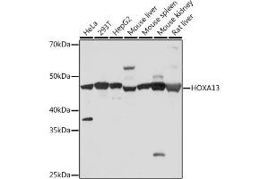 Western blot analysis of extracts of various cell lines, using HOX Rabbit mAb (ABIN7267762) at 1:500 dilution. (HOXA13 anticorps)