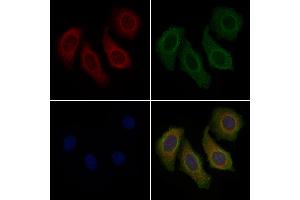 ABIN6257536 and ABIN6274704 staining Hela cells by IF/ICC. (TRAF3IP3 anticorps  (Internal Region))