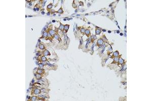 Immunohistochemistry of paraffin-embedded mouse testis using HEXA antibody (ABIN6290114) at dilution of 1:100 (40x lens). (Hexosaminidase A anticorps)