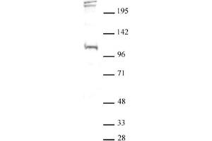Western blot of BLIMP1 / PRDM1 antibody. (PRDM1 anticorps  (N-Term))