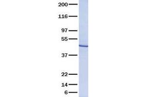 Validation with Western Blot