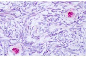 Image no. 2 for anti-BCL2-Associated Athanogene (BAG1) (AA 112-161) antibody (ABIN6749782)