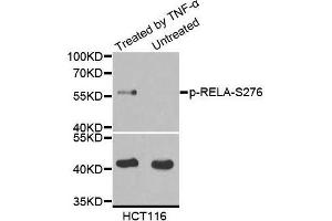 Western blot analysis of extract from Hela cells using Phospho-RELA-S276 antibody.