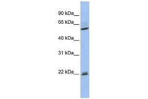 WB Suggested Anti-NR0B1 Antibody Titration: 0. (NR0B1 anticorps  (Middle Region))