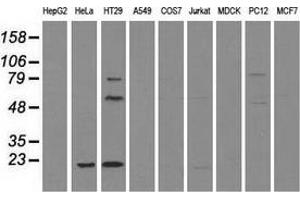 Western blot analysis of extracts (35 µg) from 9 different cell lines by using anti-CD4 monoclonal antibody.