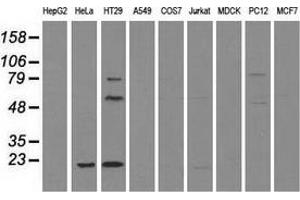 Western blot analysis of extracts (35 µg) from 9 different cell lines by using anti-CD4 monoclonal antibody. (CD4 anticorps)