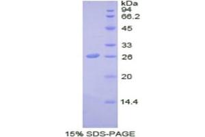 SDS-PAGE analysis of Human SDF4 Protein. (SDF4 Protéine)
