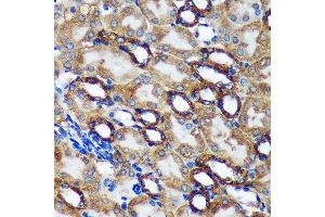 Immunohistochemistry of paraffin-embedded Mouse kidney using TMX2 Rabbit pAb (ABIN7270810) at dilution of 1:100 (40x lens).