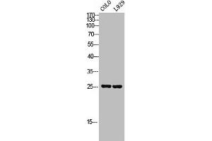 Western Blot analysis of COLO L929 cells using SRp20 Polyclonal Antibody (SRSF3 anticorps  (C-Term))