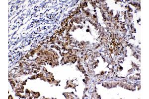 IHC analysis of MED9 using anti-MED9 antibody .