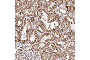 Immunohistochemical staining (Formalin-fixed paraffin-embedded sections) of human kidney with MACC1 polyclonal antibody  shows moderate cytoplasmic positivity in cells in tubules. (MACC1 anticorps)