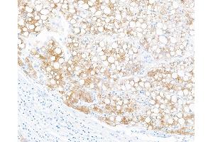 Immunohistochemistry (IHC) image for anti-Fibrinogen-Like 1 (FGL1) (AA 18-312) antibody (ABIN7453972)