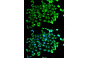 Immunofluorescence analysis of U2OS cells using APOBEC3C antibody (ABIN5973484). (APOBEC3C anticorps)