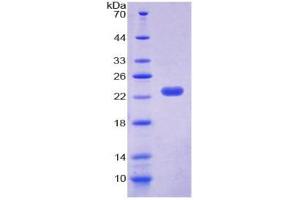 Image no. 1 for Cold Inducible RNA Binding Protein (CIRBP) (AA 1-172) protein (His tag) (ABIN4990618) (CIRBP Protein (AA 1-172) (His tag))