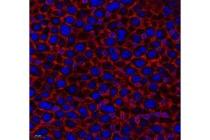 Immunofluorescence of paraffin embedded mouse liver using THNSL2 (ABIN7075893) at dilution of 1: 400 (400x lens)