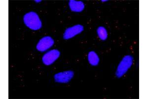 Proximity Ligation Analysis of protein-protein interactions between PRKCD and GRM5.
