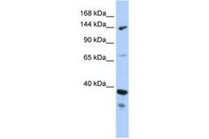 Image no. 1 for anti-DEAH (Asp-Glu-Ala-His) Box Polypeptide 37 (DHX37) (AA 71-120) antibody (ABIN6742694) (DHX37 anticorps  (AA 71-120))