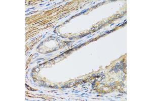 Immunohistochemistry of paraffin-embedded human prostate using CSH1 antibody (ABIN5971023) at dilution of 1/100 (40x lens).