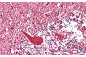 Detection of HEXb in Human Cerebellum Tissue using Polyclonal Antibody to Hexosaminidase B Beta (HEXb) (HEXB anticorps  (AA 122-311))