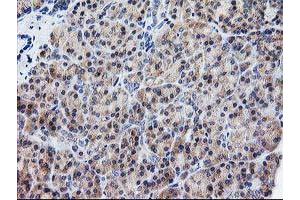 Immunohistochemistry (IHC) image for anti-ATG3 Autophagy Related 3 (ATG3) antibody (ABIN1496760) (ATG3 anticorps)