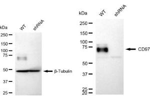 Western blotting analysis using CD97 antibody (ABIN7797988).
