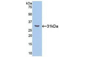 Detection of Recombinant RORa, Human using Polyclonal Antibody to RAR Related Orphan Receptor Alpha (RORa) (RORA anticorps  (AA 164-401))