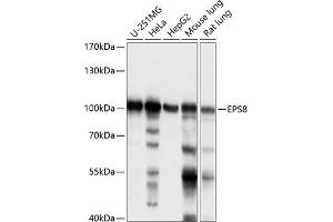 anti-Epidermal Growth Factor Receptor Pathway Substrate 8 (EPS8) (AA 1-200) antibody