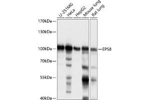 Western blot analysis of extracts of various cell lines, using EPS8 antibody (ABIN7266992) at 1:1000 dilution. (EPS8 anticorps  (AA 1-200))