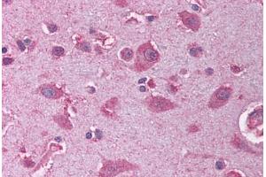 Human Brain, Cortex (formalin-fixed, paraffin-embedded) stained with OLIG2 antibody ABIN214131 at 5 ug/ml followed by biotinylated goat anti-rabbit IgG secondary antibody ABIN481713, alkaline phosphatase-streptavidin and chromogen.