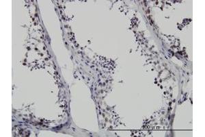 Image no. 1 for anti-Survival Motor Neuron Domain Containing 1 (SMNDC1) (AA 1-239) antibody (ABIN599128) (SMNDC1 anticorps  (AA 1-239))